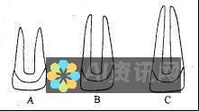 医学诊断：根据症状和病史预测疾病。