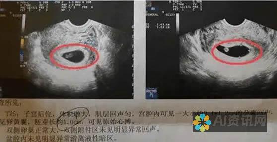 四维图片合成中的 AI 挑战与机遇：提升精准度与优化用户体验