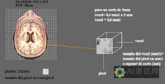 VoxelMorph：一个用于医学图像配准和分割的深度学习平台。