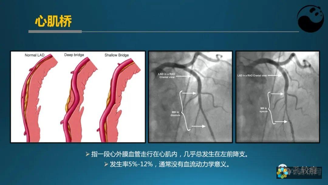 完全指南：如何在没有账户的情况下访问 ChatGPT 主界面